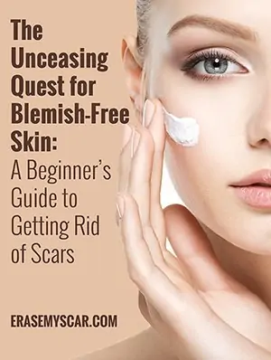 Scar Removal - Image 3